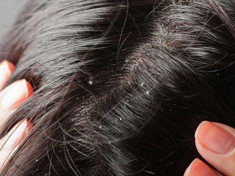 头发果子中草药洗发水可以长期使用吗？